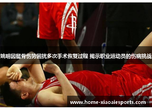 姚明因腿骨伤势困扰多次手术恢复过程 揭示职业运动员的伤病挑战 姚明因腿骨伤势困扰多次手术恢复过程 揭示职业运动员的伤病挑战